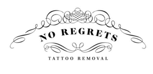 no regrets tattoo removal in the uk